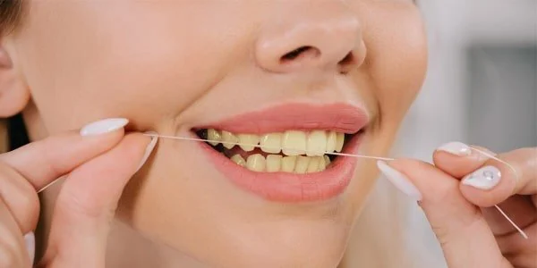dental_france_compare_before_v2.jpg